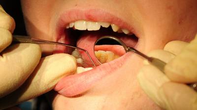 Dentists ‘astonished’ by lack of detail in plan to improve access to care
