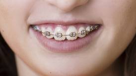 More than 18,200 children   waiting for orthodontic treatment
